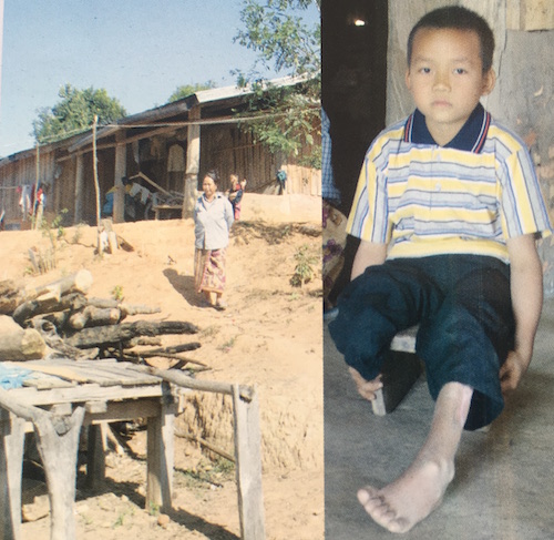 Santar COPE Connect Laos